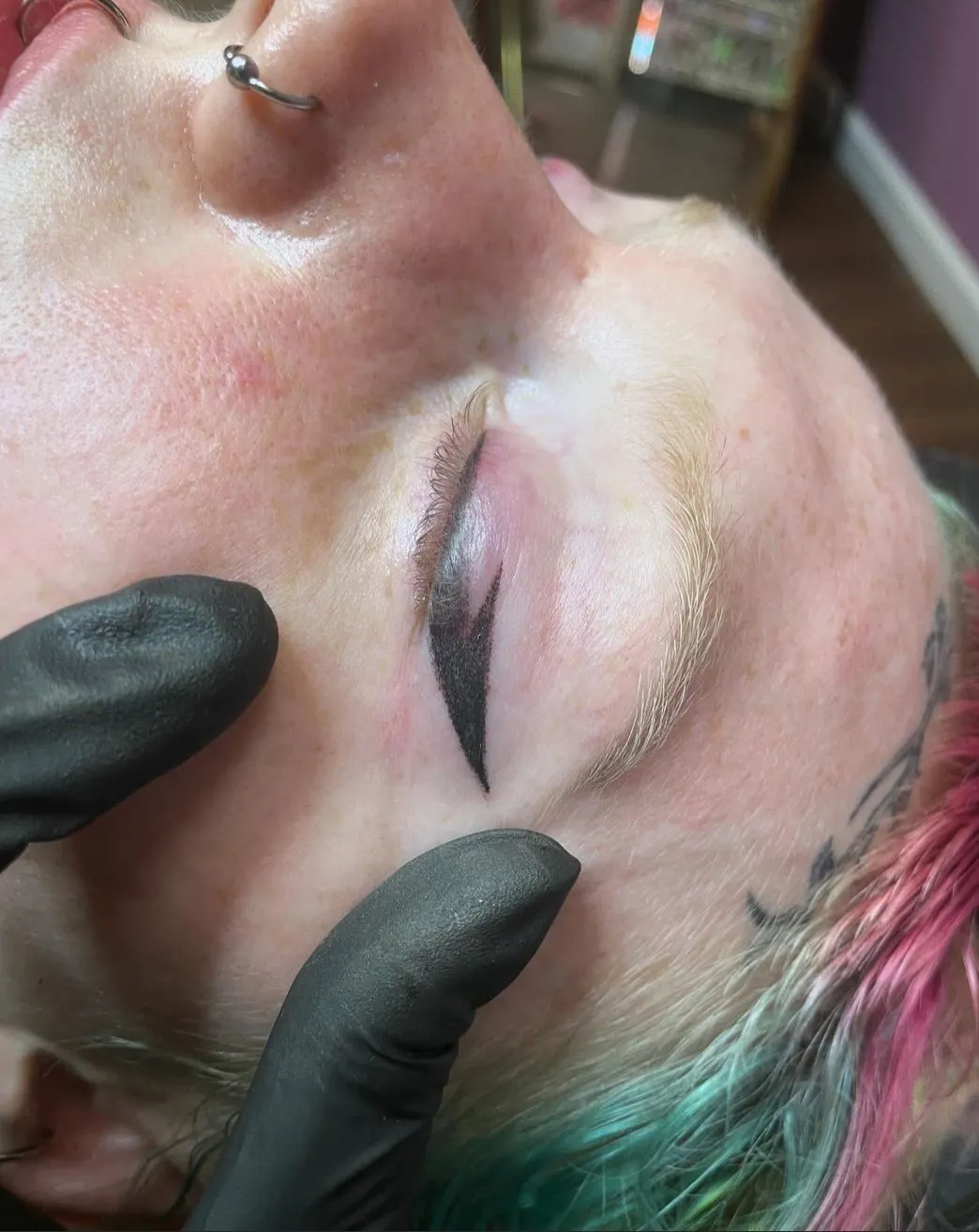 Aftercare and Healing Process