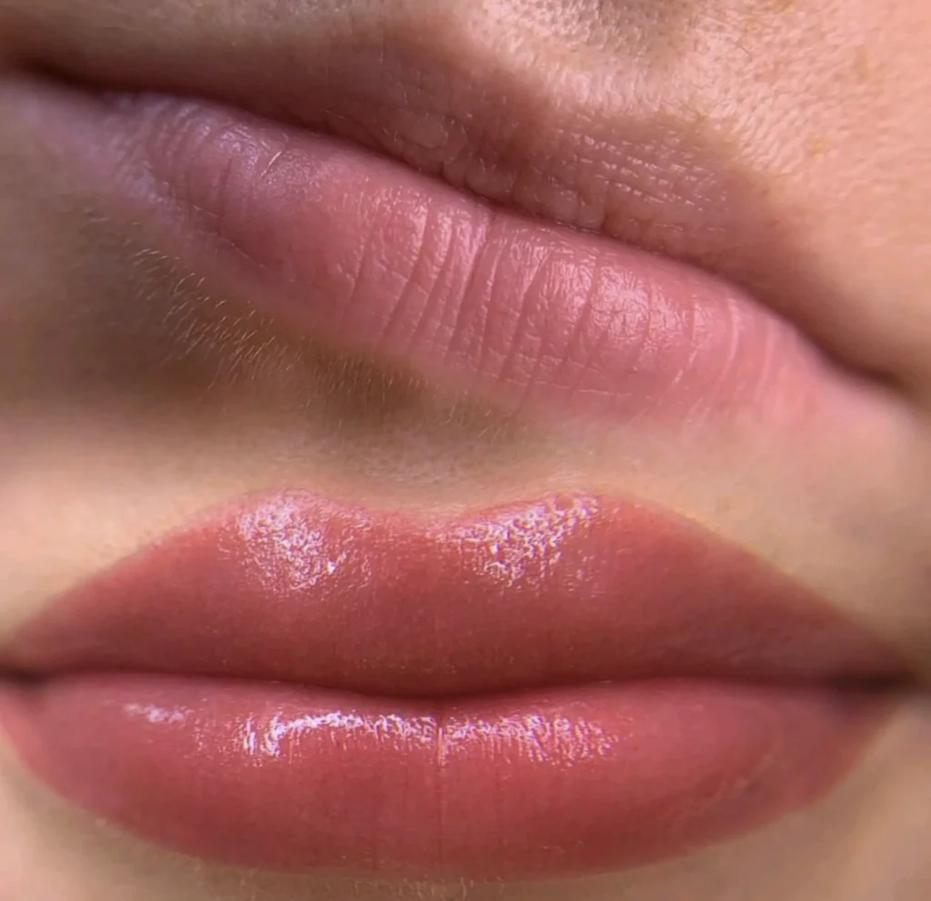 lip neutralization