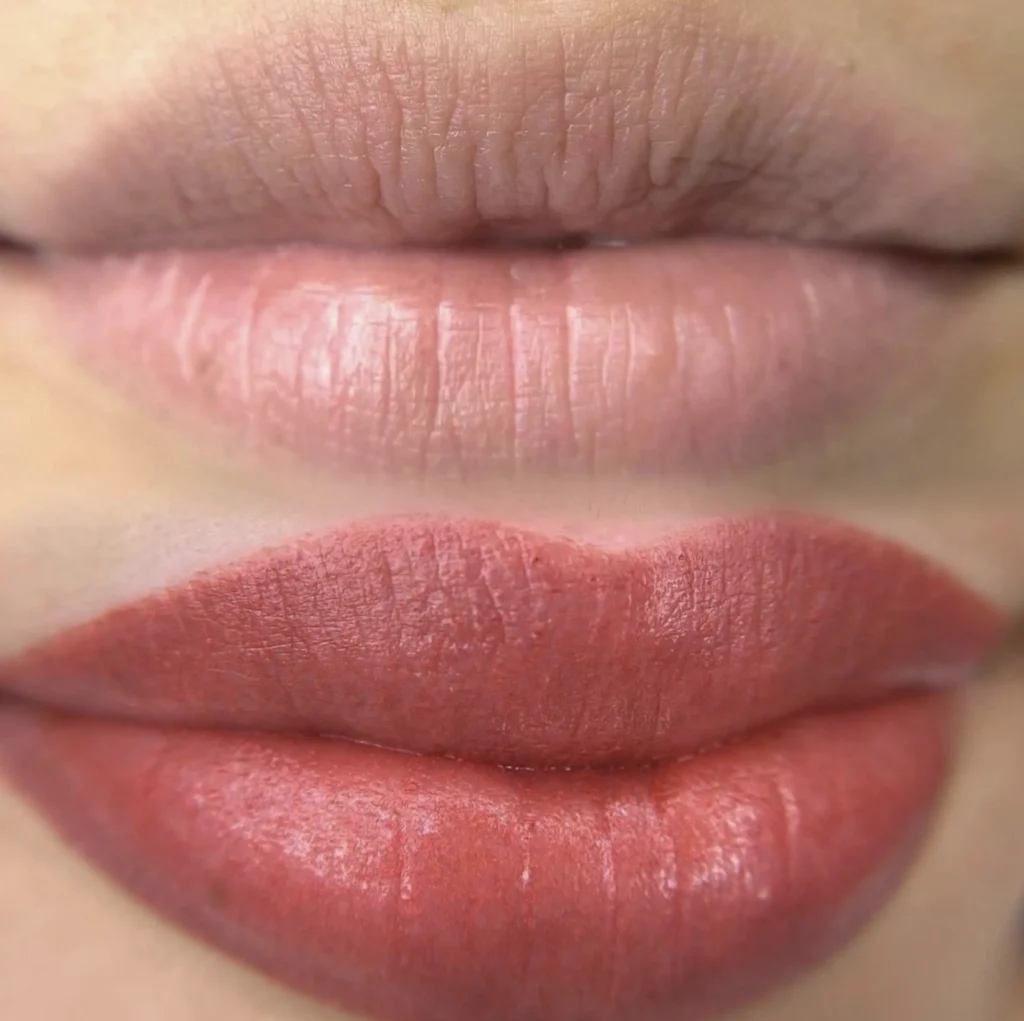 lip neutralization healing process